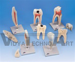 Classic Tooth Model Series, 5 models